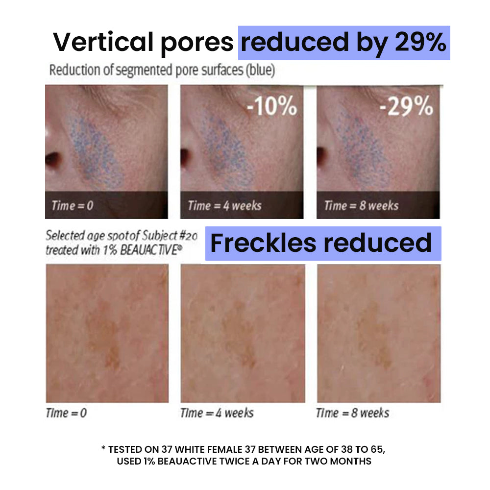 Pore Zero Peeling Mousse