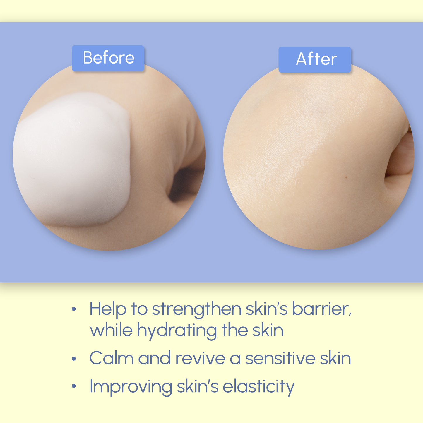 SUR.MEDIC+ AZULENE SOOTHING MOUSSE TONER