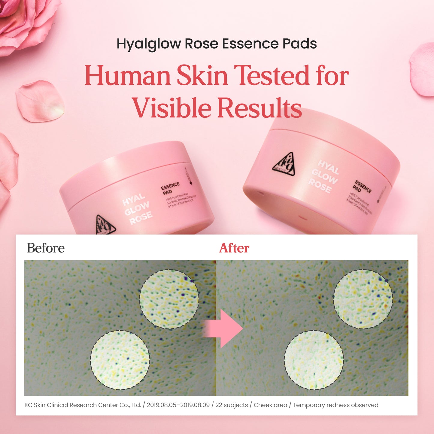 Hyal Glow Rose Essence Pad (70 Pads)