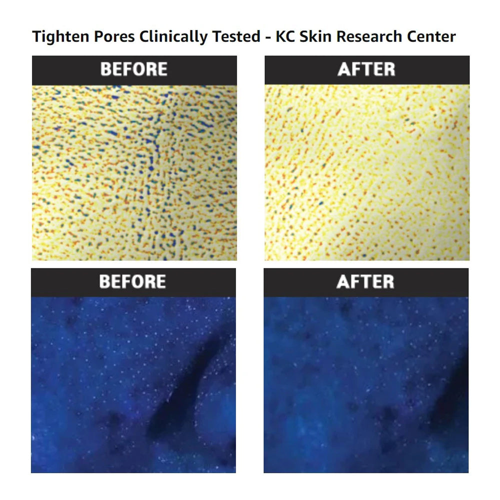 Pore Tight Peeling Mousse