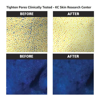 Pore Tight Peeling Mousse