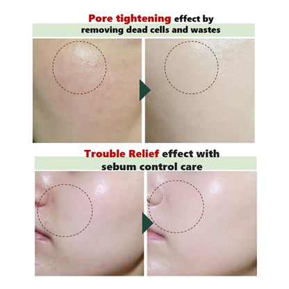 Pore Zero Peeling Mousse