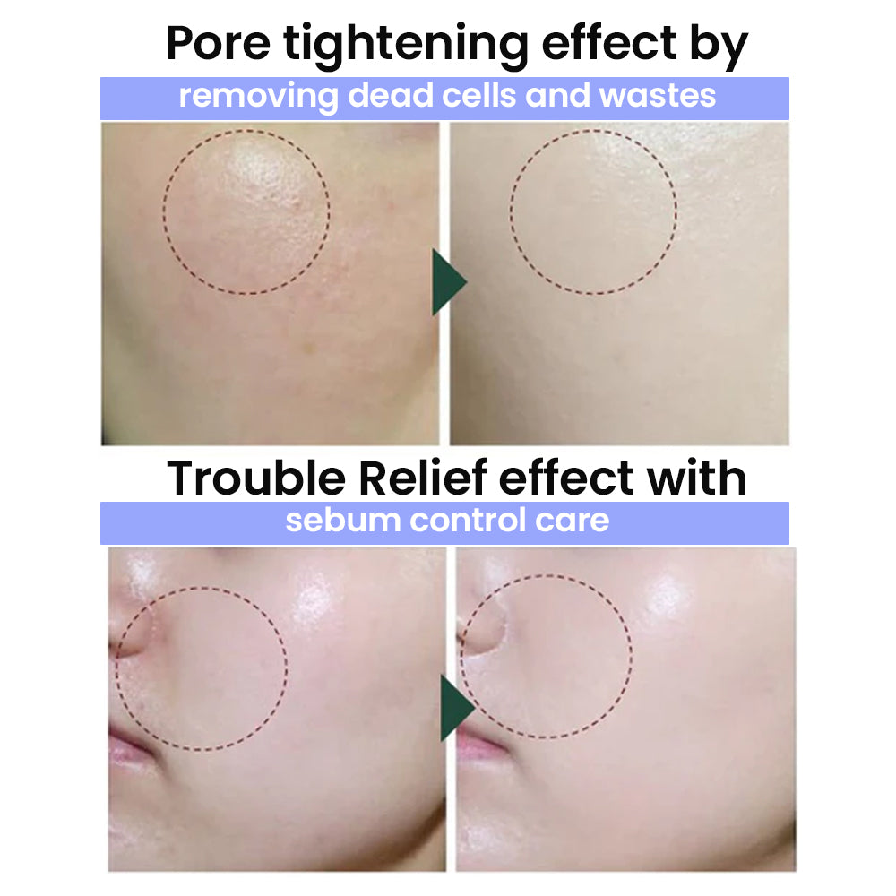 Pore Zero Peeling Mousse