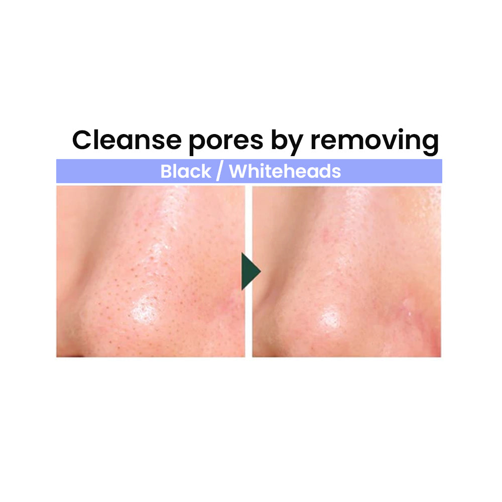 Pore Zero Peeling Mousse