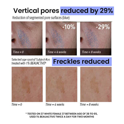 Pore Zero Peeling Mousse