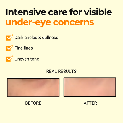 Next Clear Eye Cream 20ml